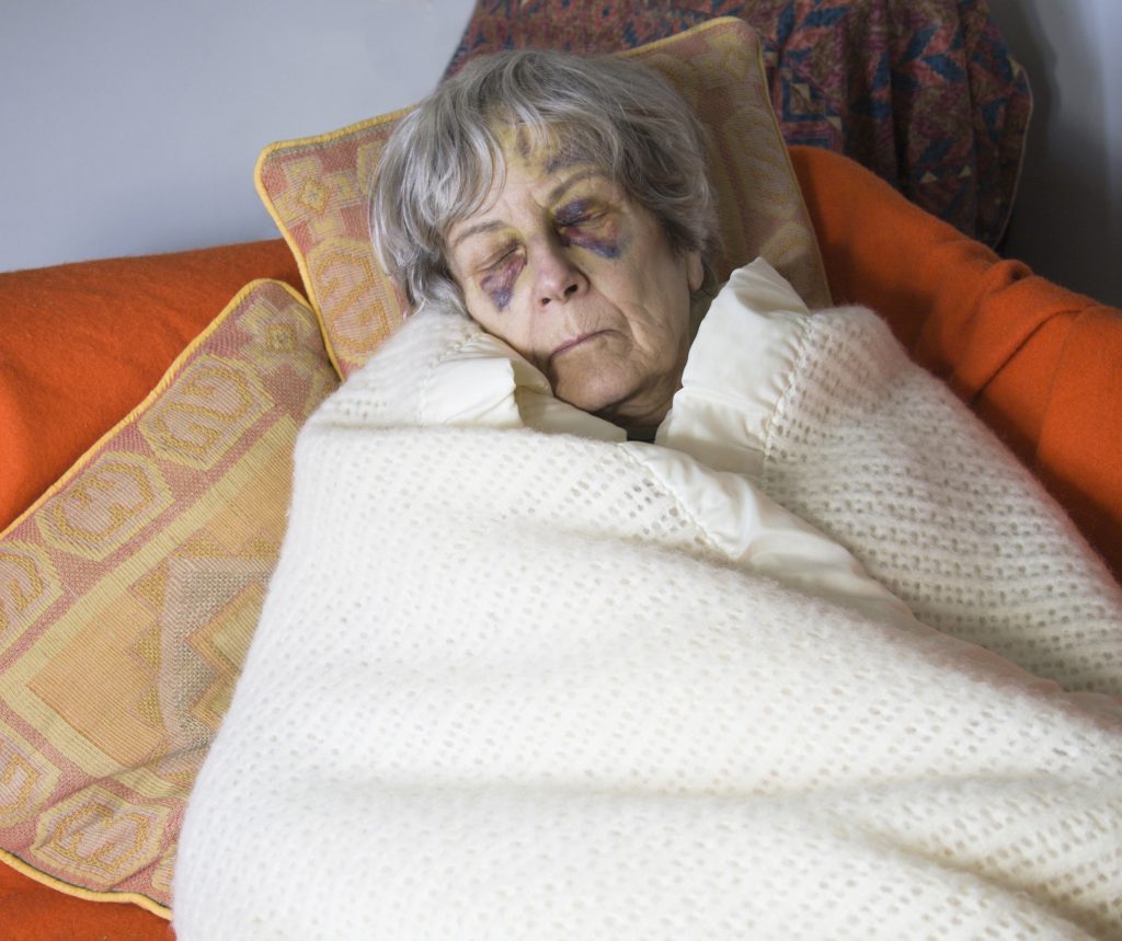 Elder Care Abuse